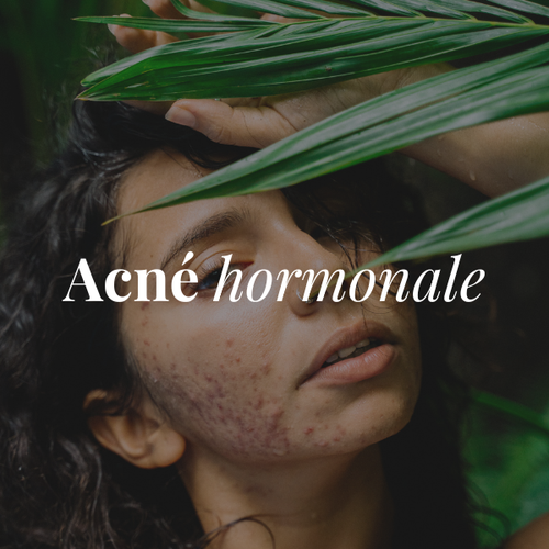 Acné hormonale – Grossesse & Post-Partum