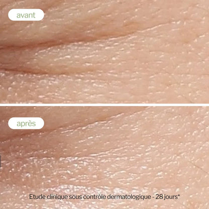 Sérum Booster Anti-Taches au Thé Vert・Novexpert