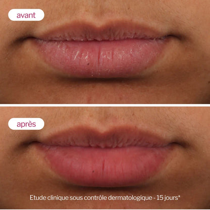 Lip’Up・Novexpert
